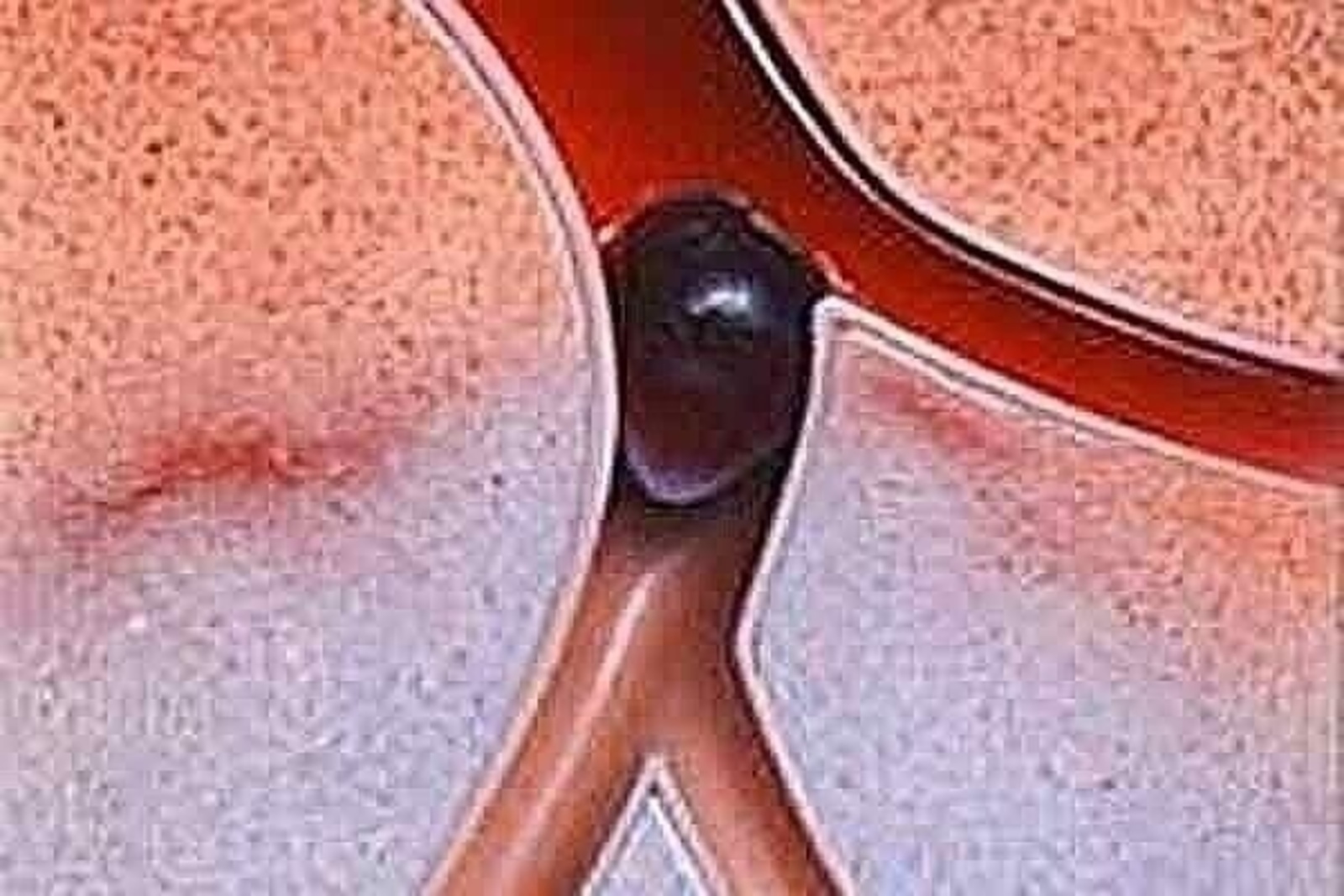 Ҡанды шыйығайтыу өсөн ниндәй ризыҡтар ашарға?